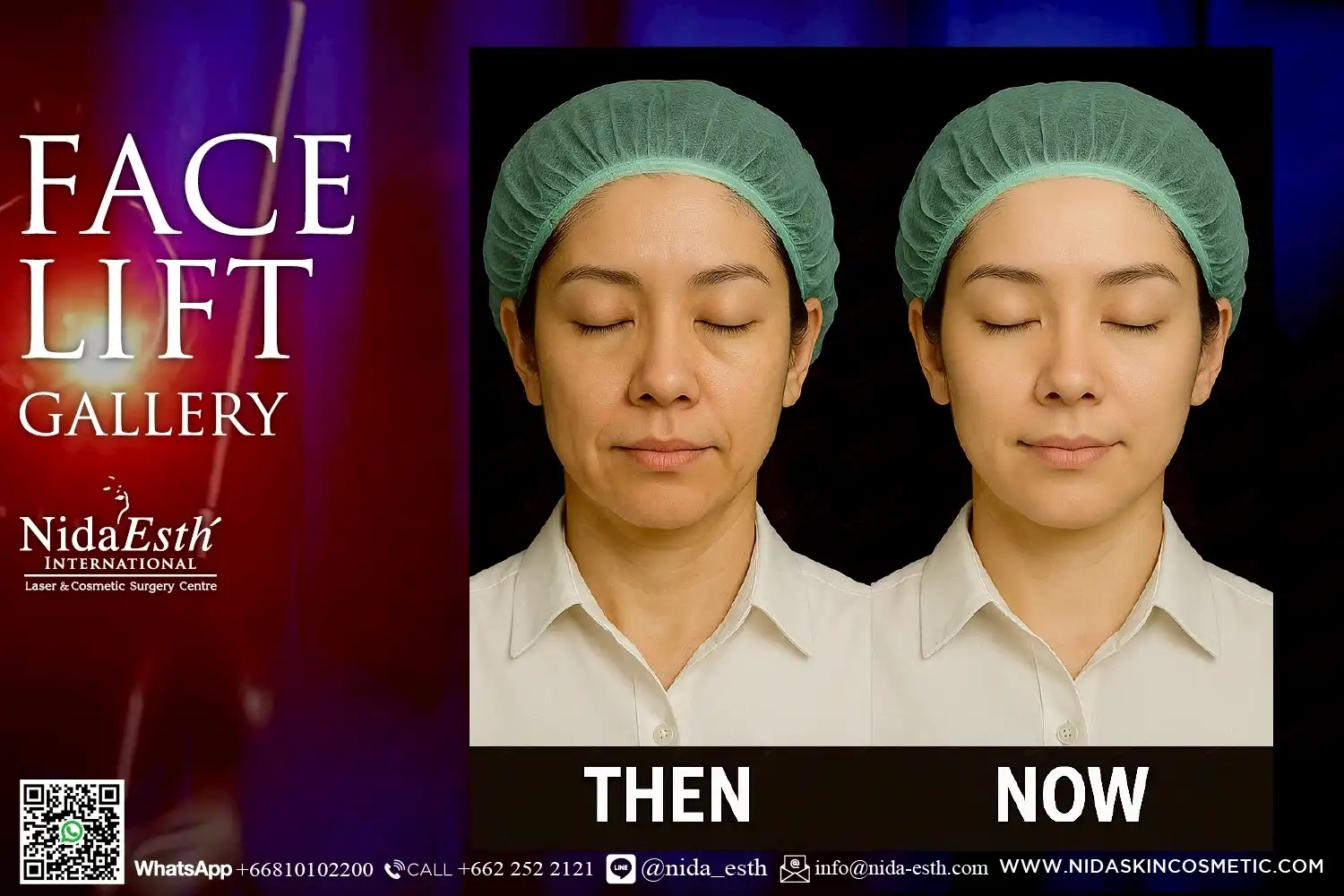 LINE_ALBUM_BA Infinity Lift X_250509_10