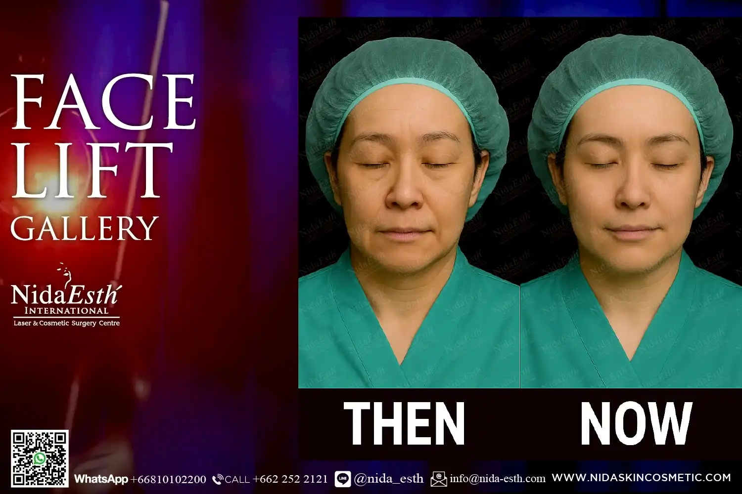 LINE_ALBUM_BA Infinity Lift X_250509_12