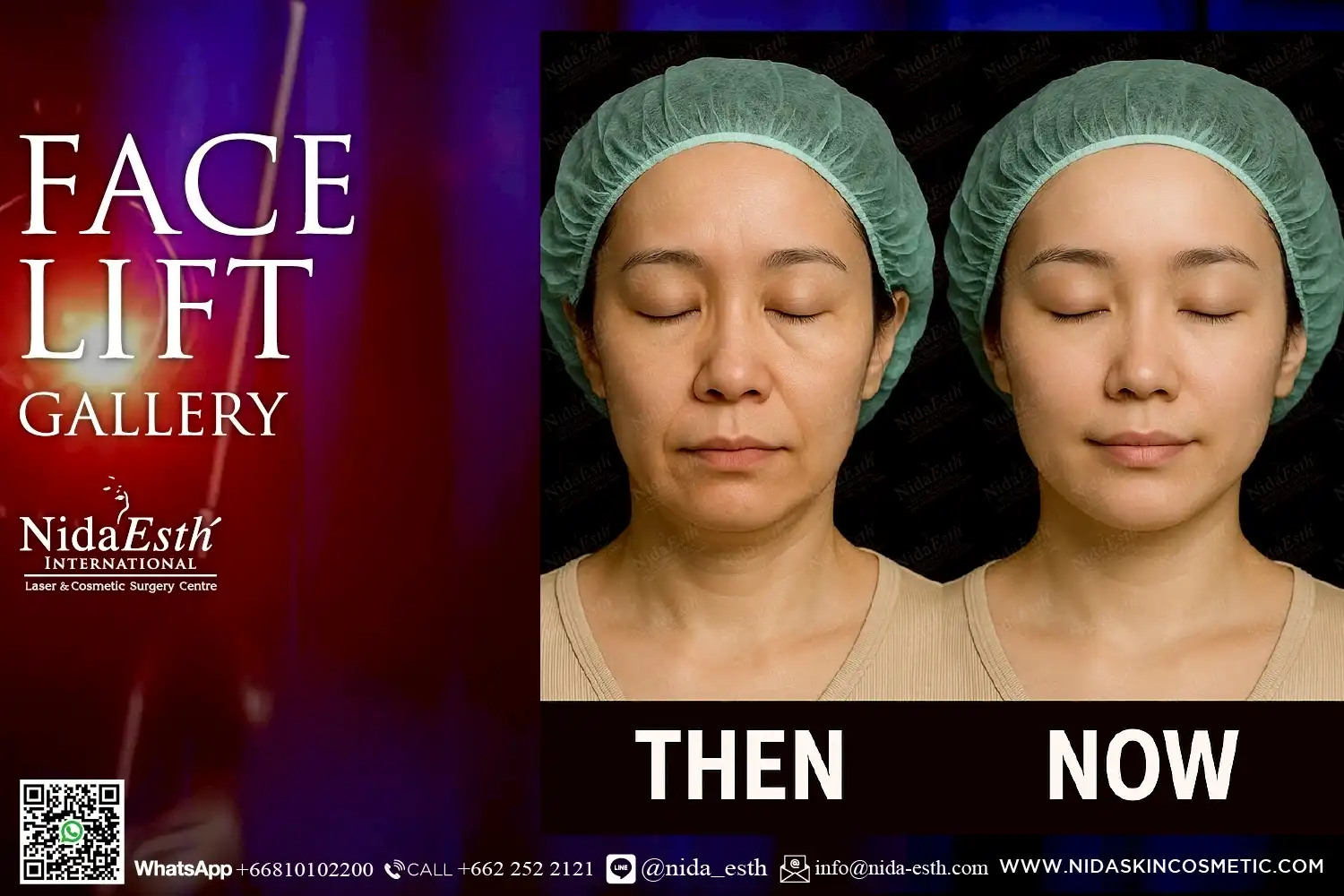 LINE_ALBUM_BA Infinity Lift X_250509_14