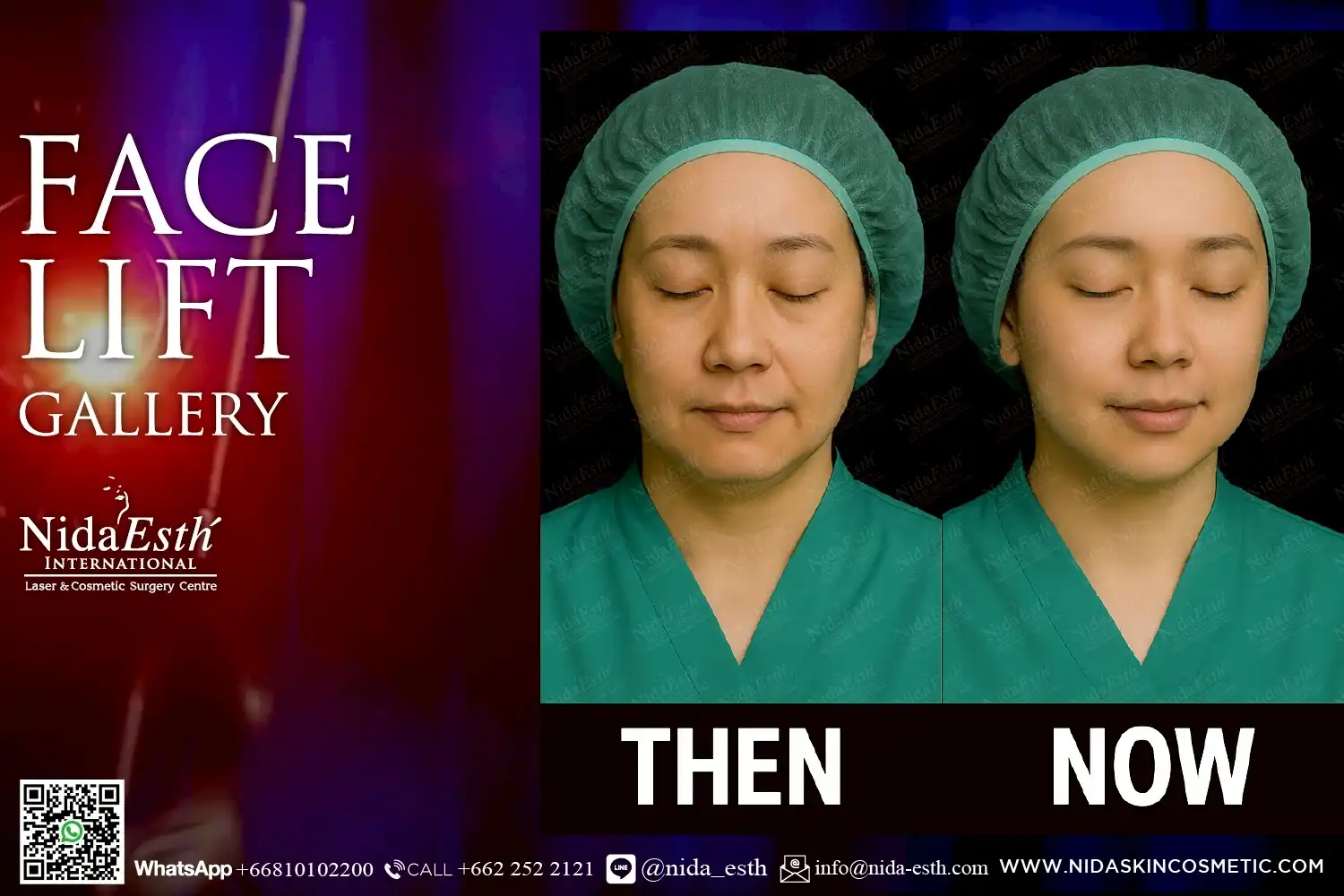 LINE_ALBUM_BA Infinity Lift X_250509_16