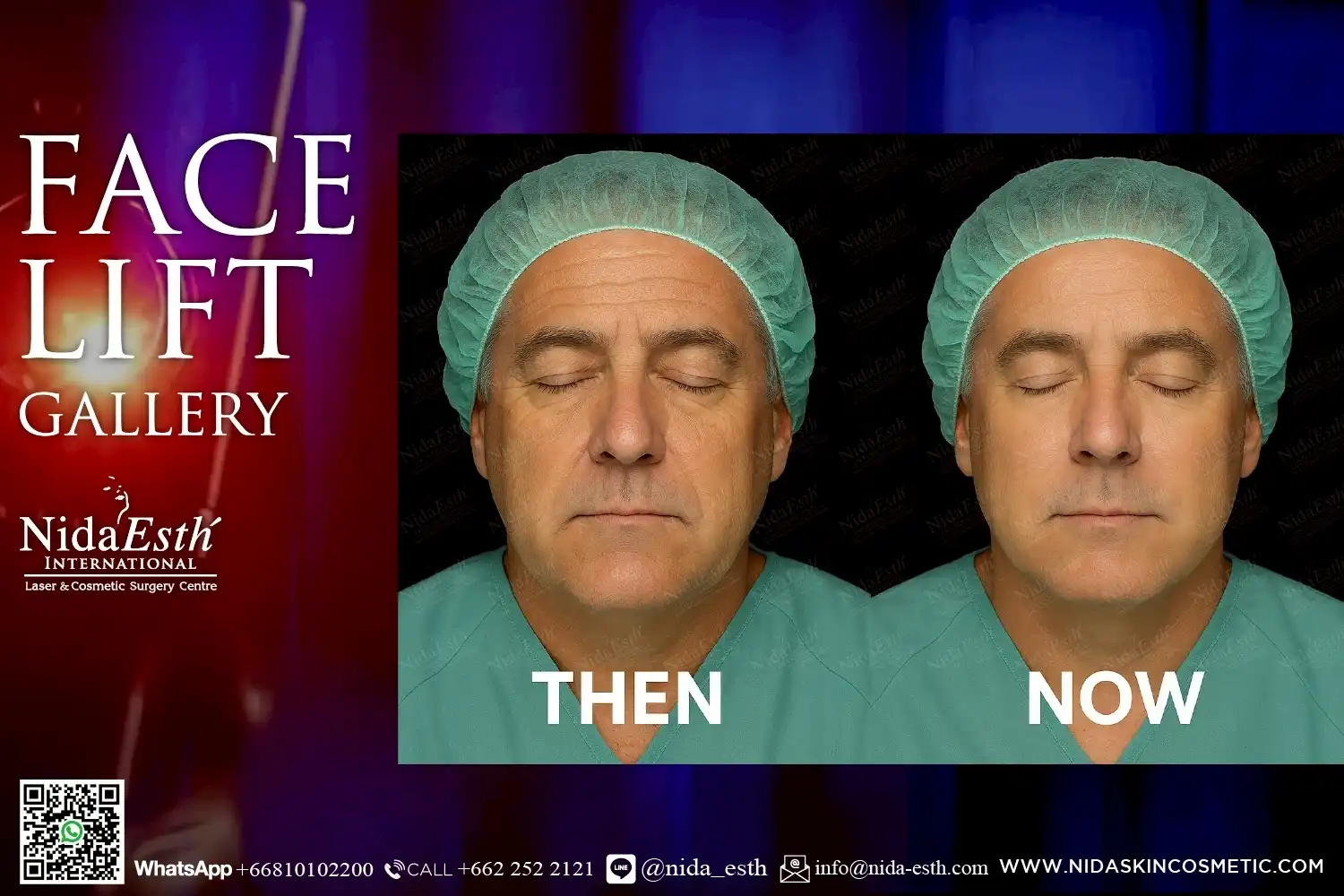 LINE_ALBUM_BA Infinity Lift X_250509_17