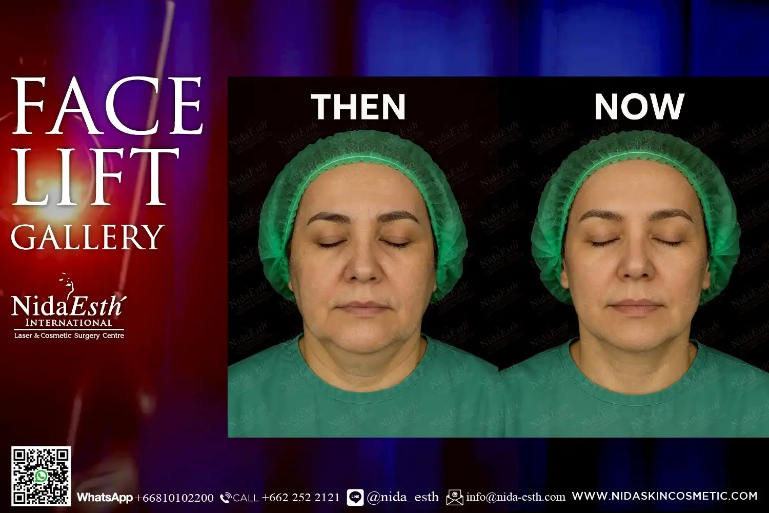 LINE_ALBUM_BA Infinity Lift X_250509_18