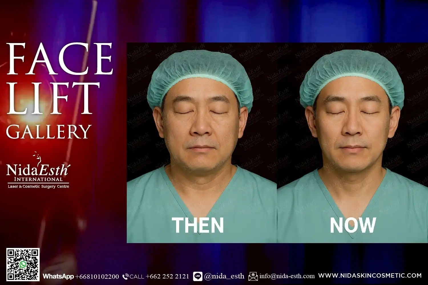 LINE_ALBUM_BA Infinity Lift X_250509_20