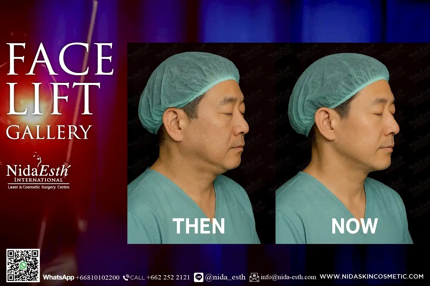 LINE_ALBUM_BA Infinity Lift X_250509_21