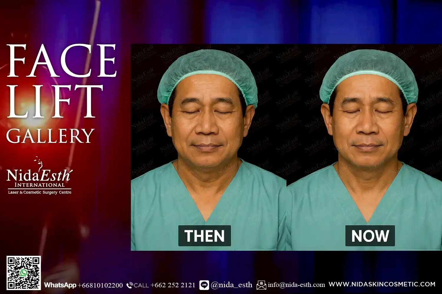 LINE_ALBUM_BA Infinity Lift X_250509_22