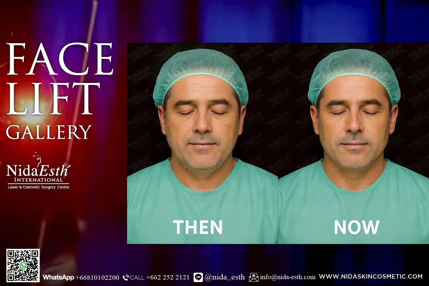 LINE_ALBUM_BA Infinity Lift X_250509_23