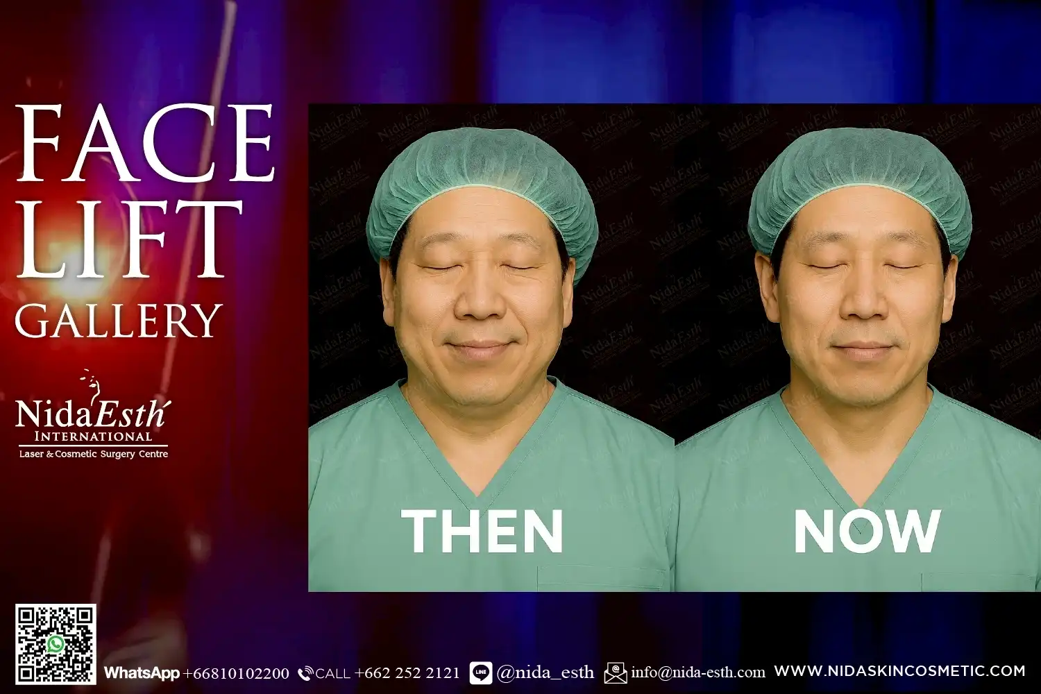 LINE_ALBUM_BA Infinity Lift X_250509_24